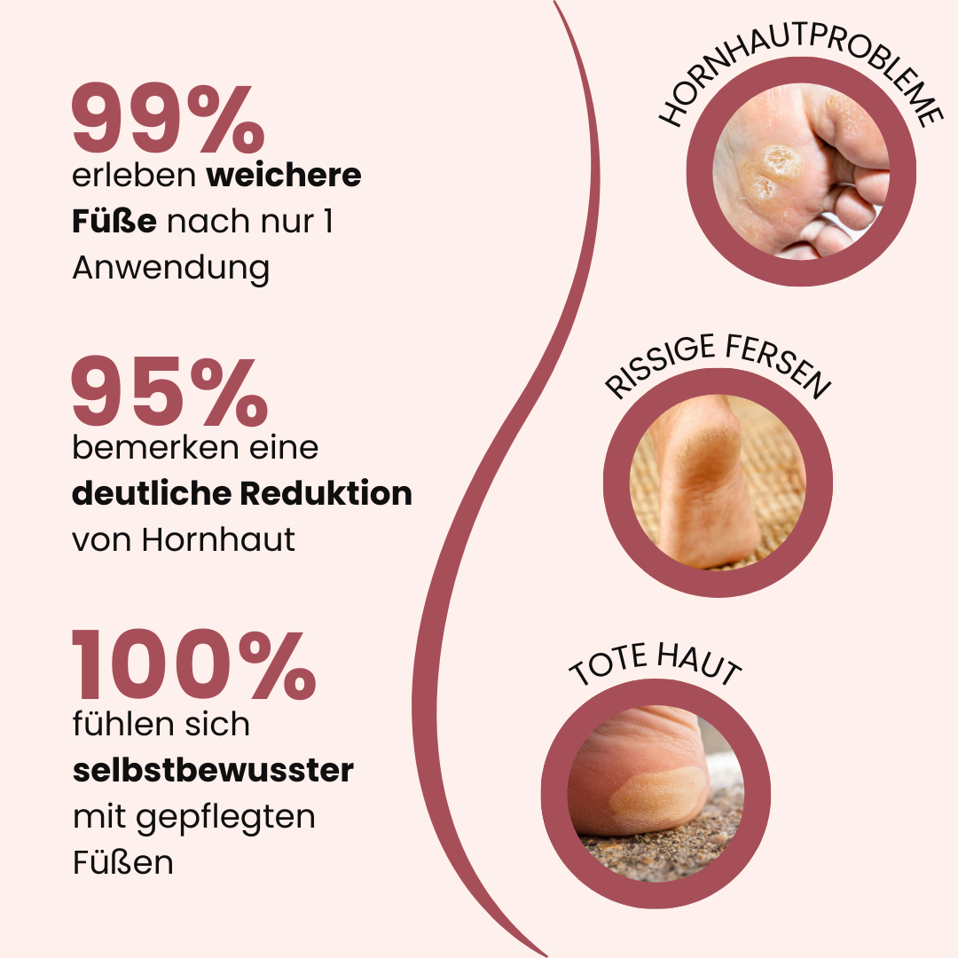 DermaLove Pro inkl. 60 Glide Pads (Gratis)